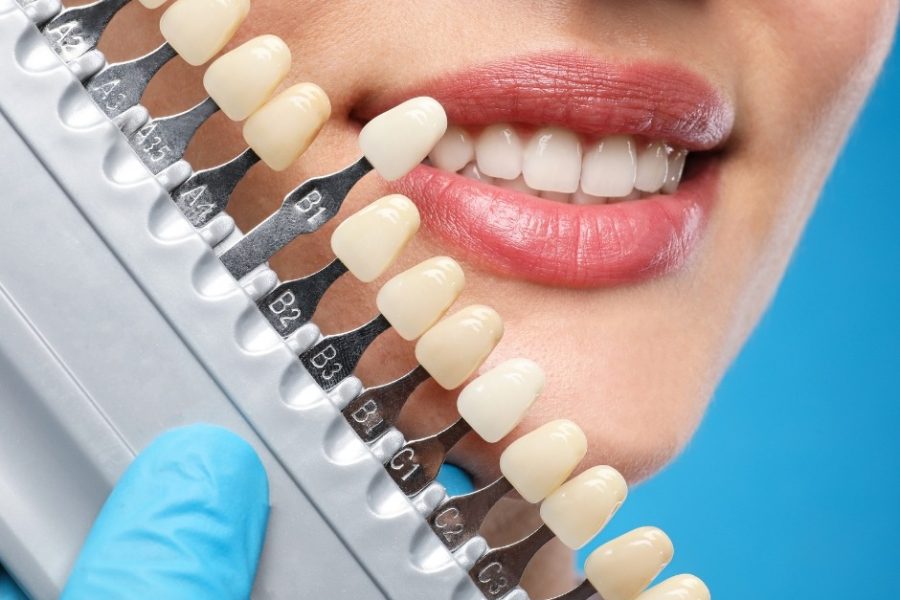 general dentistry in chandigarh