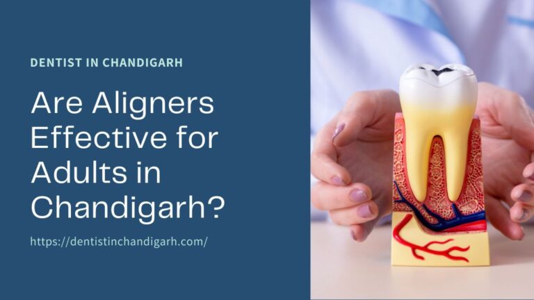 Are Aligners Effective for Adults in Chandigarh?