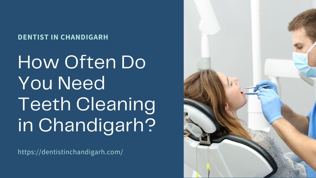 How Often Do You Need Teeth Cleaning in Chandigarh?