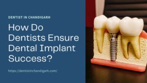 Dental Implant