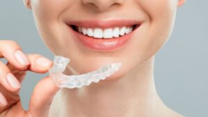 Clear Aligners