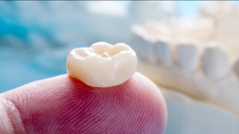 root canal